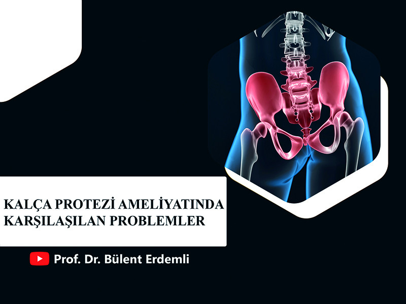 kalca-protezi-ameliyatinda-karsilasilan-problemler-prof-dr-bulent-erdemli