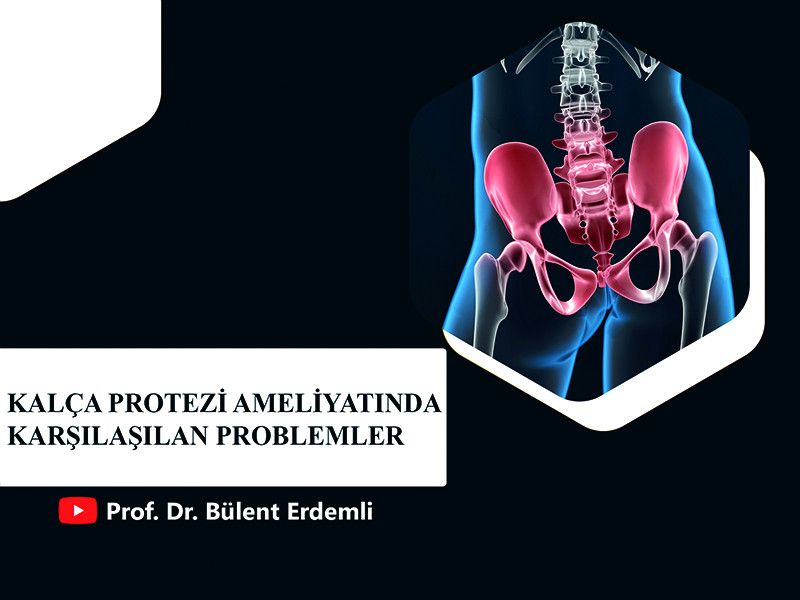 kalça protezi,kalça protezi ameliyatı,ankara kalça protezi,istanbul kalça protezi,kalça protezi ameliyatı ile ilgili bilinmesi gerekenler