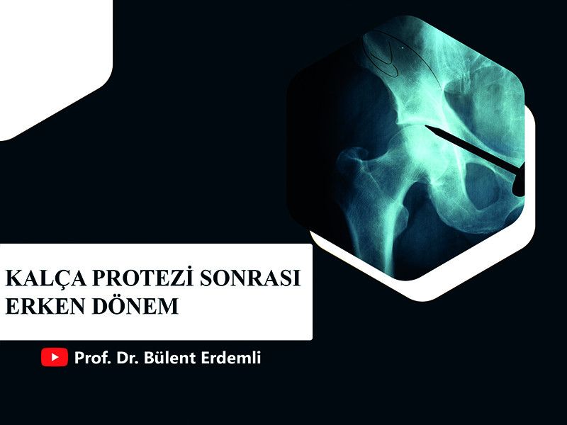 kalca-protezi-sonrasi-erken-donem